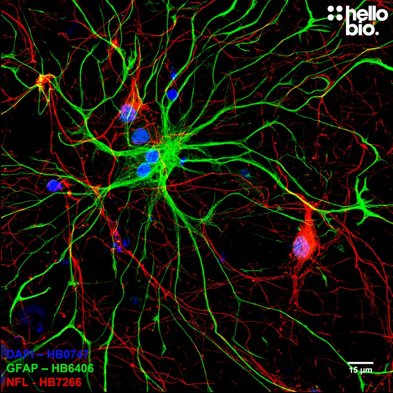 <p>Cytoplasmic filaments of astrocytes in CNS </p>
