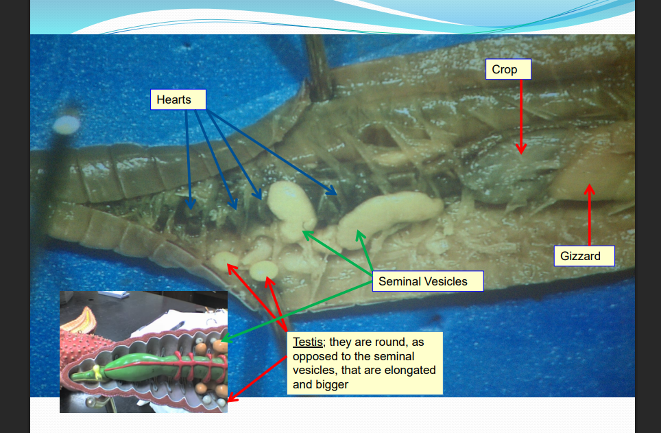 <p>Earthworms dissection</p>