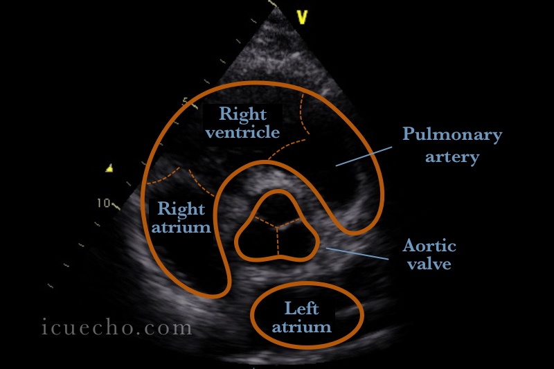 <p>For this image define the probe location, index mark orientation, and how to obtain this image.</p>