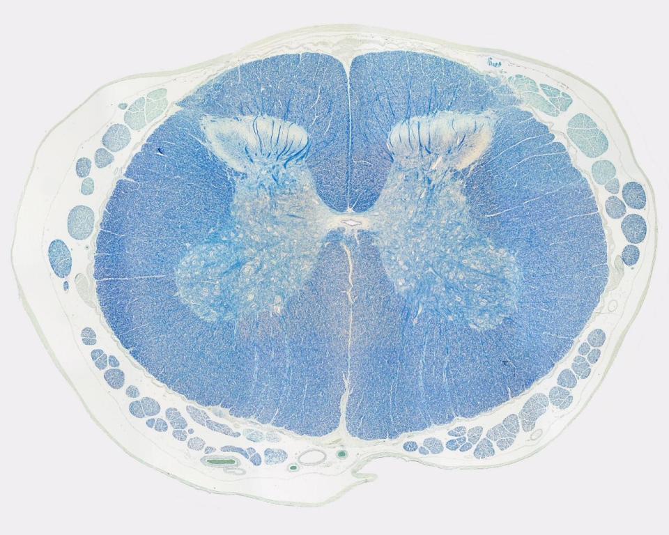 <p>Identifica la plaquita</p>