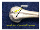<p>tubercle</p>