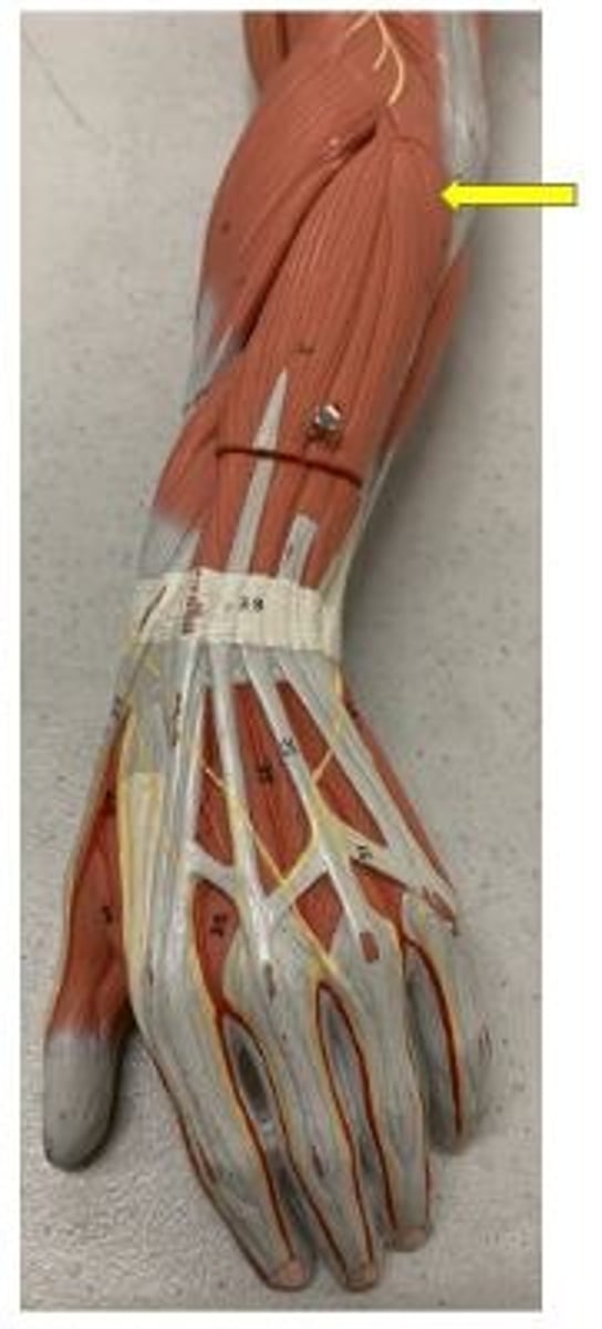 <p>extension of elbow</p>