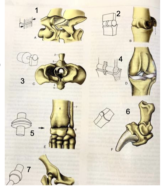 <p>Label these synovial joints</p>