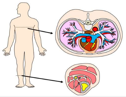 term image