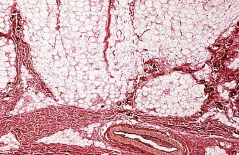 <p>What layer of the skin is this?</p>