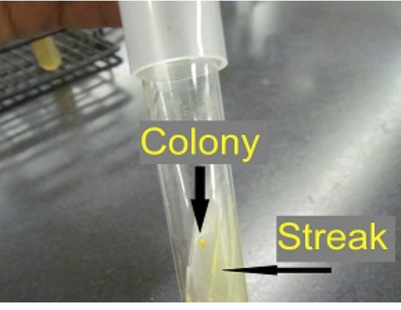 <p><span>What error in aseptic technique most likely caused this contaminant colony to grow on this agar slant</span></p>