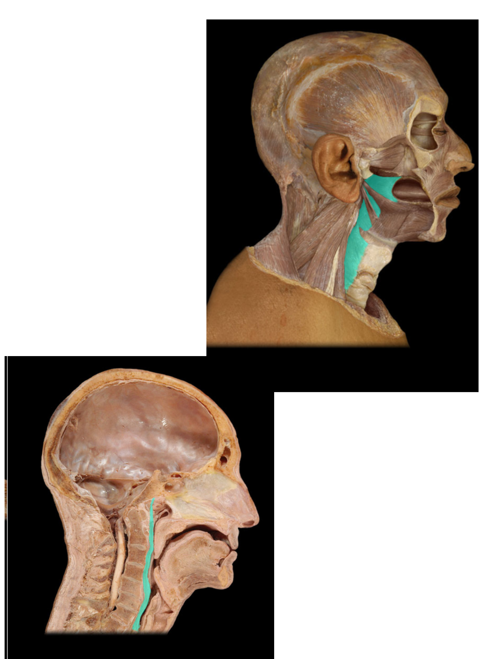 <p>Pharyngeal constrictor mm</p>