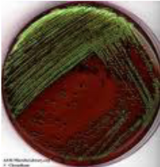 <p>What is EMB agar selective for?</p>