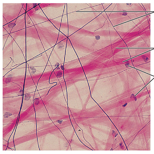 <p>which tissue is this</p>