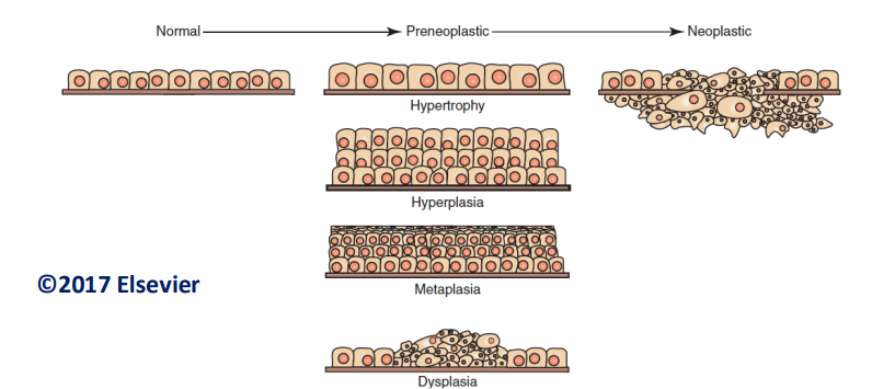 <ul><li><p>Hypertrophy</p></li><li><p>Hyperplasia</p></li><li><p>Metaplasia</p></li><li><p>Dysplasia</p></li><li><p>Anaplasia/Atypia</p></li></ul><p></p>