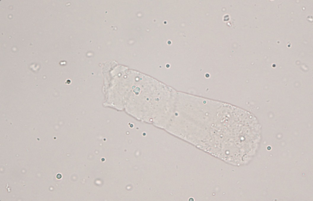 <p>What type of cast is this?</p>