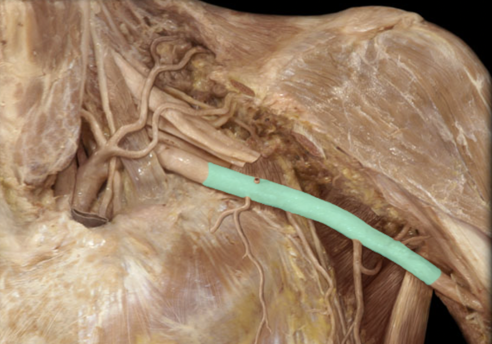 <p>Identify the blood vessel of the upper extremity</p>