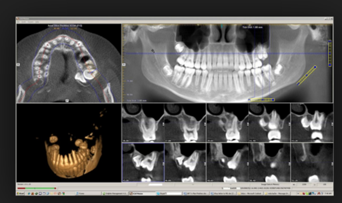 <p>Computed tomography radiography function-</p><p>CBCT-<span>Cone Beam Computed Tomography</span></p>