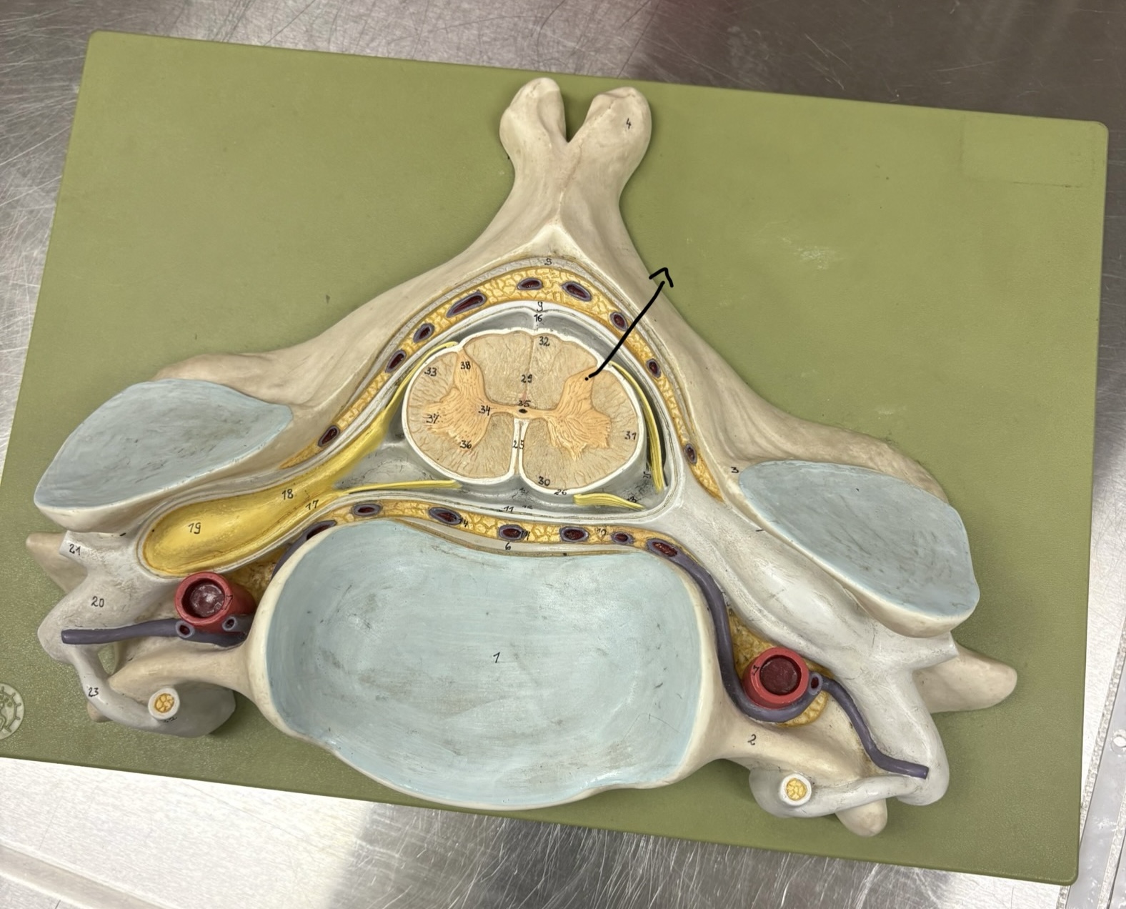 <p>Which neuron type cell bodies are located here?</p>