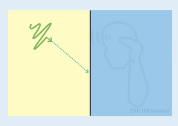 <ul><li><p>sound beam strikes boundary at an angle other than 90 degrees</p></li><li><p>synonyms:</p><ul><li><p>not at right angles</p></li><li><p>non-perpendicular</p></li></ul></li></ul><p></p>