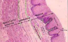 <p>extra esophagus histology</p>