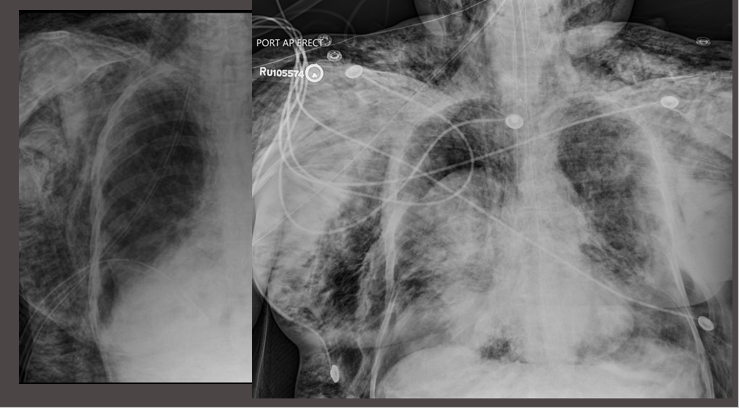 <p>what pathology is this?</p>