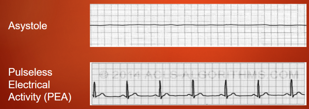 <ul><li><p>Asystole</p></li><li><p>Pulseless Electrical Activity (PEA)</p></li></ul><p></p>