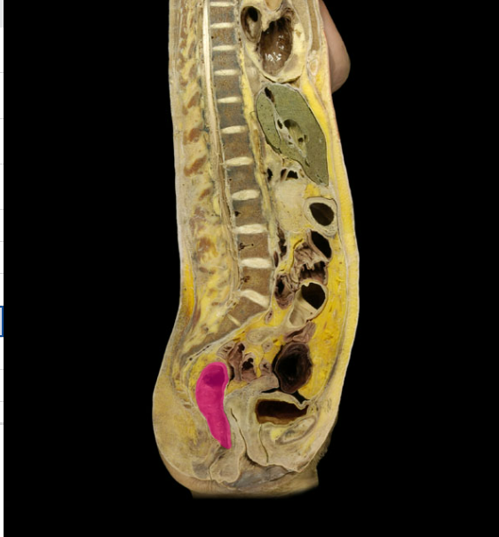 <p>what organ is this</p>