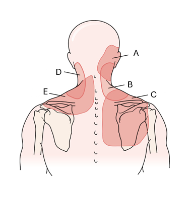 <p>B</p>