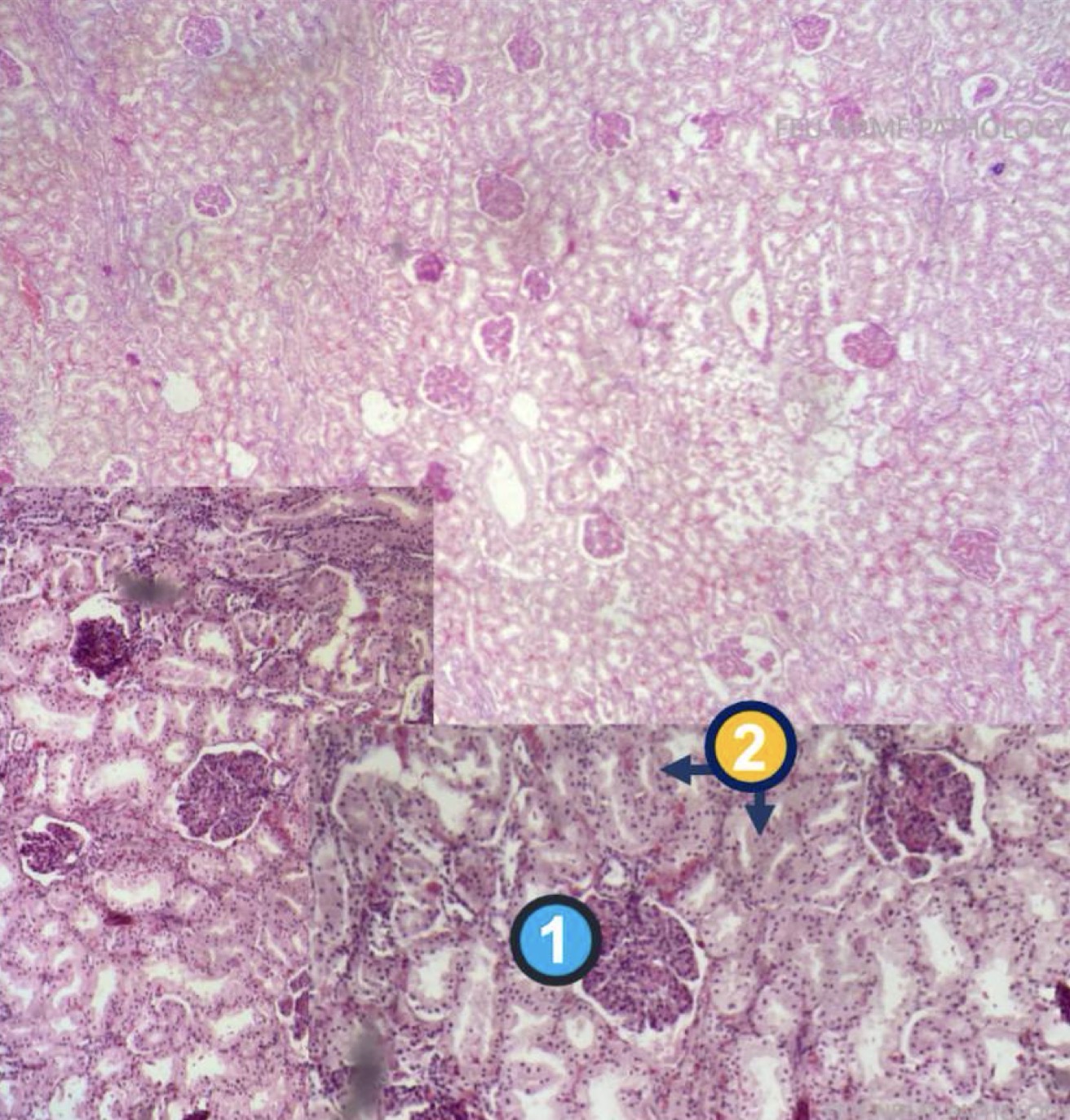 <p>Diagnose, identify the pointed structures, and identify if reversible or irreversible</p>