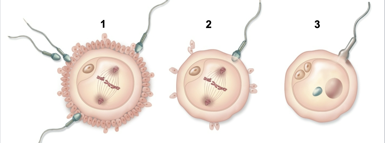 <p></p><p>1. Corona radiata penetration</p><p>2. Acrosome reaction and zona pellucida penetration</p><p>3. Fusion of sperm and oocyte plasma membranes</p><p>and pronuclei</p>