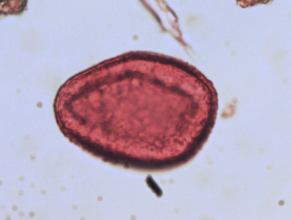 <p>Identify the pollen grains to the <strong>Family </strong>level</p>