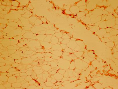 <p>identify the tissue</p>