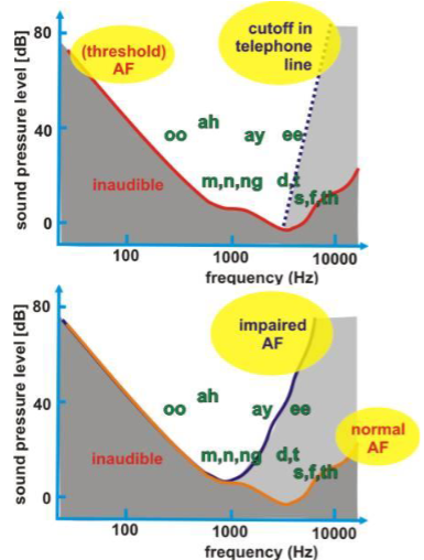 <ul><li><p>Speech sounds cover a wide range of the audible spectrum</p></li><li><p>Current mobile phone tech only transmits 300-3400Hz</p></li><li><p>Age-related hearing loss = higher frequencies</p></li><li><p>Noise-related hearing loss = temp shifts in threshold or permanent damage</p></li><li><p>Tinnitus = continuous ringing/humming</p></li></ul><p></p>