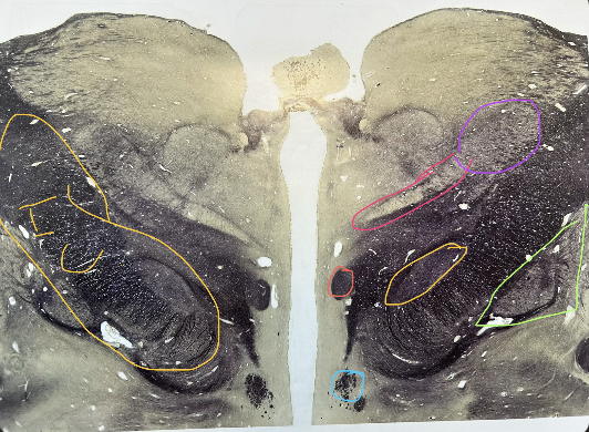 <p>whats in green </p>