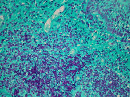 <p>Feulgen Reaction reagents</p><p>Hydrozyler: </p><p>Primary stain:</p><p>Differentiator:</p><p>Counter stain:</p>