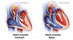 <p>When the ventricles relax and fill with blood</p>
