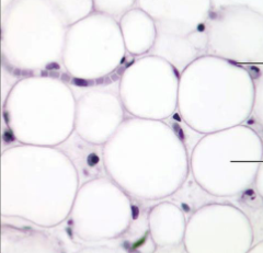 <p>what kind of connective tissue is this</p>