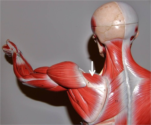 <p>What muscle is this?</p>