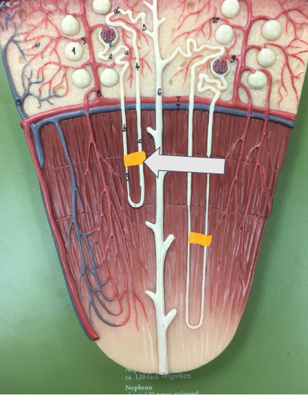 <p>Name this type of nephron</p>