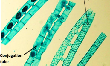 <p>What is this?<br><br>A) Spirogyra<br>B) Volvox<br>C) Euglena<br>D) Anabaena</p>