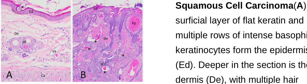 <p>Neoplasia/ Neoplastic Disease:<strong>Malignant Neoplasms PICTURES</strong></p>