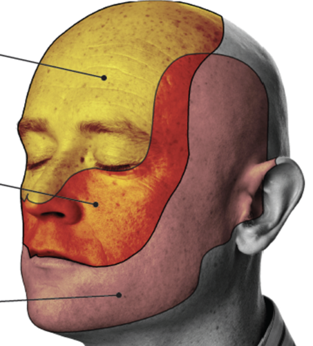 <p>Identify the dermatome in red (middle). What nerve(s) participate in this sensation?</p>