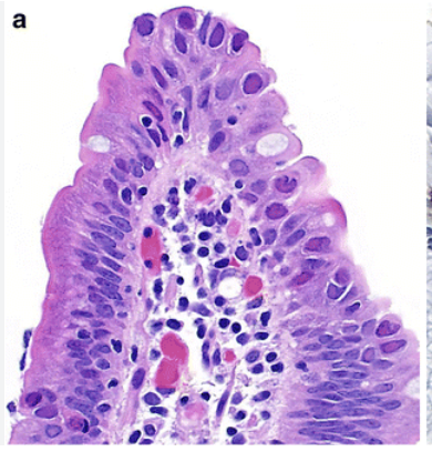 <p>Estomac, diagnostic </p>