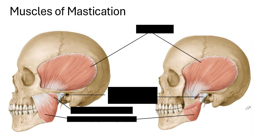 <p>Label the Muscles of Mastication </p>