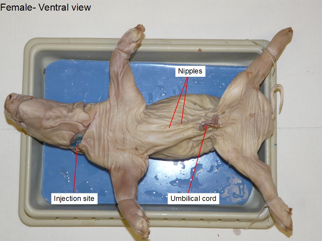 <p><span style="background-color: transparent;">Structure connecting the fetus to the placenta, supplying oxygen and nutrients while removing wastes.</span></p>