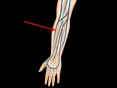 <p>cephalic vein</p>