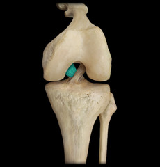 <p>Resists posterior translation of the tibia relative to a fixed femur OKC</p><p>Resists anterior translation of the femur relative to a fixed tibia CKC</p>