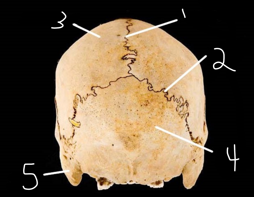 <p>where is parietal bone?</p>