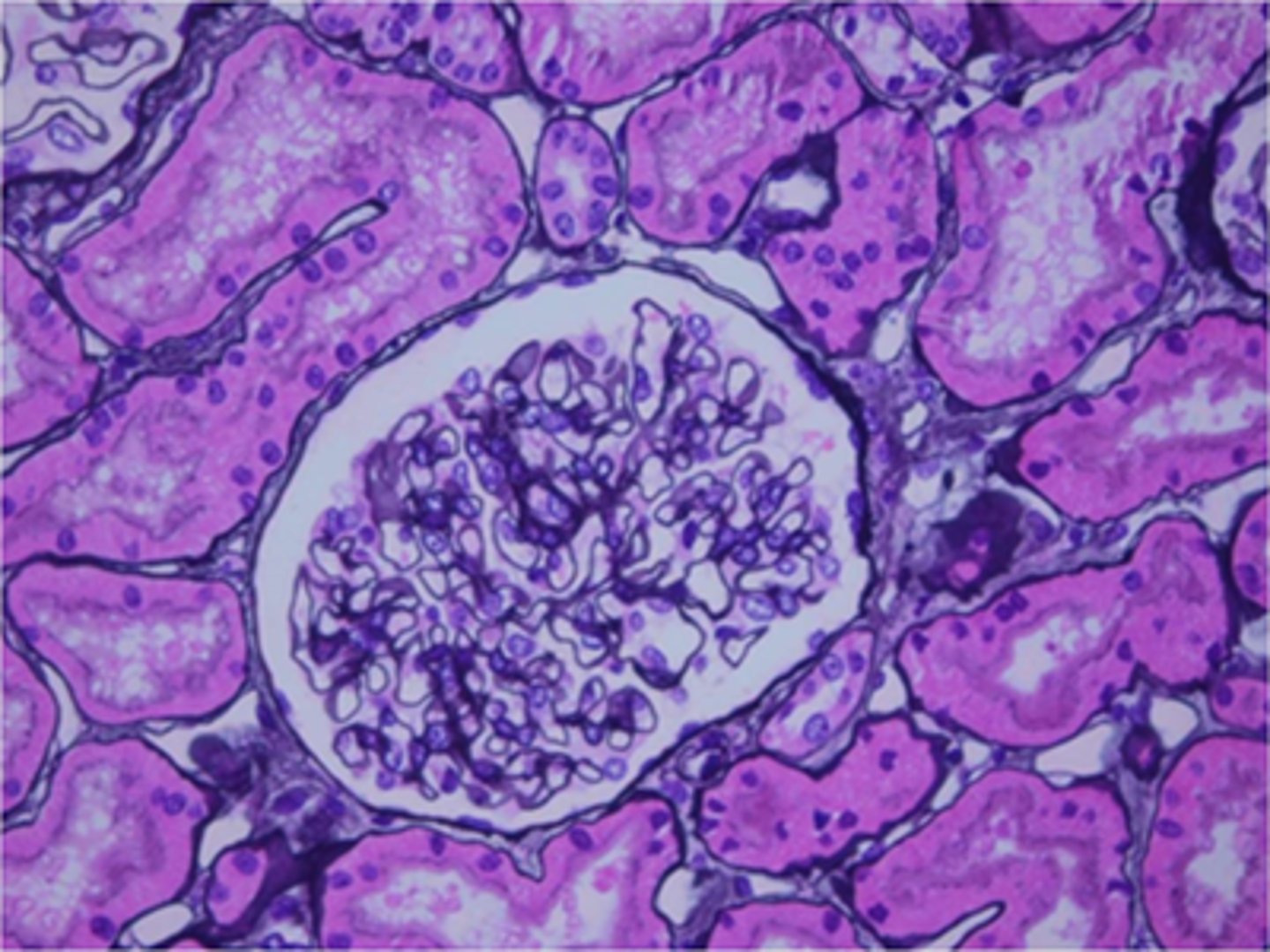 <p>basement membrane</p><p>Feedback:</p><p>The basement membrane is stained black in this Jones-stained sections of kidney.</p>