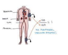 <p>- 2 ratios/patient </p><p>- L leg systolic/highest brachial BP</p><p>- R leg systolic/highest brachial BP</p><p>- use index plus other signs of vascular impairment to determine risk for PAD</p><p>- other signs: color, skin changes, sensation</p>
