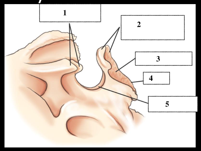 <p>What bone is it? </p><p>Label</p>