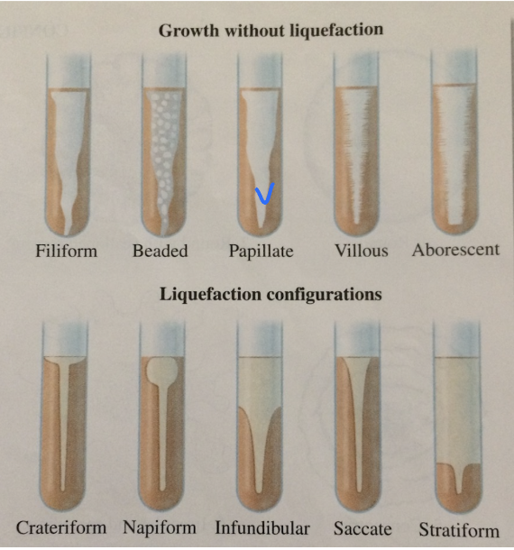 <p>see if bact. breaks down gelatin by making gelatinase</p><ul><li><p><strong>medium:</strong> nutrient gelatin deep</p></li><li><p><strong>test or pH indicator:</strong> gelatin (test indicator)</p></li><li><p><strong>negative: </strong>solid → solid (no liquefaction)</p></li><li><p><strong>positive: </strong>solid → liquefaction</p></li></ul><p></p>