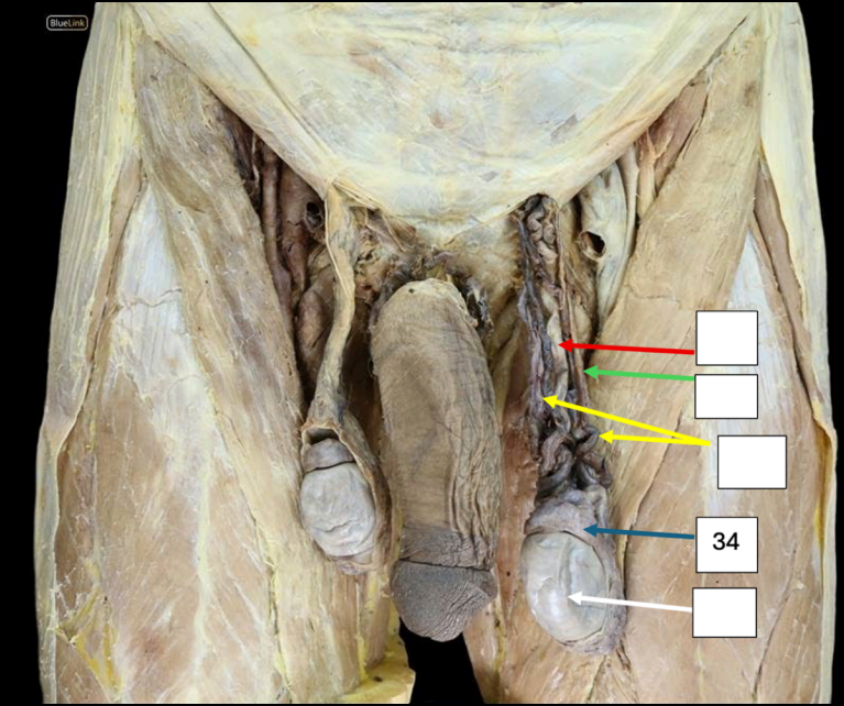 <p>Identify</p><p>Side Question:</p><p>This structure lies in which position to the testis?</p><p>What structure lies on its medial side?</p><p>Blood Supply?</p><p>Venous Drainage?</p><p>Nerve Supply?</p><p>Lymph Drainage?</p>