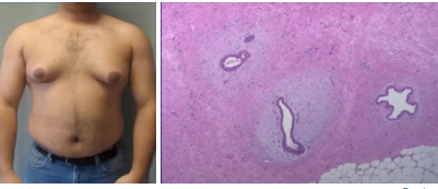 <p>What pathology?</p>